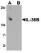 Interleukin 36 Beta antibody, TA326666, Origene, Western Blot image 