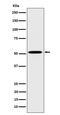 Hepatocyte Nuclear Factor 4 Alpha antibody, M00389-4, Boster Biological Technology, Western Blot image 