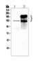 Carcinoembryonic Antigen Related Cell Adhesion Molecule 5 antibody, A00356, Boster Biological Technology, Western Blot image 