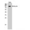 Nuclear Factor Kappa B Subunit 2 antibody, LS-C384868, Lifespan Biosciences, Western Blot image 