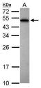 Poly(A) Binding Protein Nuclear 1 antibody, GTX101490, GeneTex, Western Blot image 