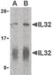 Interleukin 32 antibody, PA5-20221, Invitrogen Antibodies, Western Blot image 