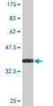 Nuclear Receptor Subfamily 1 Group D Member 1 antibody, H00009572-M15, Novus Biologicals, Western Blot image 