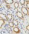 Phosphoglycerate Kinase 1 antibody, MBS9208093, MyBioSource, Immunohistochemistry paraffin image 