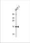 RNA Polymerase II Subunit J3 antibody, TA328157, Origene, Western Blot image 