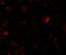 PH Domain And Leucine Rich Repeat Protein Phosphatase 2 antibody, 7021, ProSci, Immunofluorescence image 