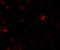 PH domain leucine-rich repeat-containing protein phosphatase 2 antibody, 7021, ProSci, Immunofluorescence image 