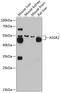 Asialoglycoprotein Receptor 2 antibody, 14-157, ProSci, Western Blot image 