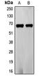 Frizzled Class Receptor 5 antibody, LS-C353034, Lifespan Biosciences, Western Blot image 
