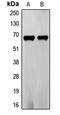 Frizzled-5 antibody, LS-C353034, Lifespan Biosciences, Western Blot image 