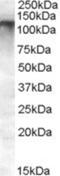 ATP Binding Cassette Subfamily C Member 11 antibody, NBP1-20944, Novus Biologicals, Western Blot image 