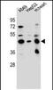 Leucine Rich Repeat Containing 28 antibody, PA5-71720, Invitrogen Antibodies, Western Blot image 