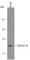 Charcot-Leyden Crystal Galectin antibody, AF5447, R&D Systems, Western Blot image 