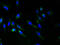 Ring Finger Protein 148 antibody, A60634-100, Epigentek, Immunofluorescence image 