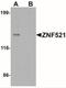 Zinc Finger Protein 521 antibody, NBP2-41174, Novus Biologicals, Western Blot image 