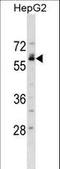 Nuclear Factor I B antibody, LS-C158380, Lifespan Biosciences, Western Blot image 