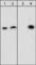 Dystroglycan 1 antibody, DM1171, ECM Biosciences, Western Blot image 