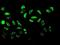 DEAD-Box Helicase 5 antibody, ab126730, Abcam, Immunocytochemistry image 