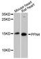 Profilin Family Member 4 antibody, LS-C748727, Lifespan Biosciences, Western Blot image 