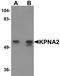 Karyopherin Subunit Alpha 2 antibody, orb94587, Biorbyt, Western Blot image 