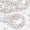 SPT3 Homolog, SAGA And STAGA Complex Component antibody, NBP1-87007, Novus Biologicals, Immunohistochemistry paraffin image 