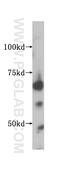 Insulin-like growth factor 2 mRNA-binding protein 2 antibody, 11601-1-AP, Proteintech Group, Western Blot image 