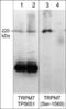 Transient Receptor Potential Cation Channel Subfamily M Member 7 antibody, TP5651, ECM Biosciences, Western Blot image 