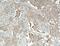 Cadherin 3 antibody, Biotin-13773, Proteintech Group, Immunohistochemistry paraffin image 