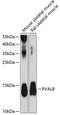 Parvalbumin antibody, 15-053, ProSci, Western Blot image 