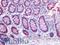 Stearoyl-CoA Desaturase antibody, LS-B3941, Lifespan Biosciences, Immunohistochemistry paraffin image 
