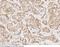 Brevican antibody, 102837-T08, Sino Biological, Immunohistochemistry paraffin image 