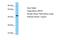 ADP Ribosylation Factor Interacting Protein 2 antibody, A30023, Boster Biological Technology, Western Blot image 