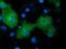 NIMA Related Kinase 11 antibody, GTX84060, GeneTex, Immunofluorescence image 