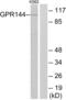 Adhesion G Protein-Coupled Receptor D2 antibody, abx015304, Abbexa, Western Blot image 