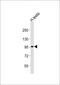 Ubiquitin Specific Peptidase 13 antibody, MBS9211391, MyBioSource, Western Blot image 