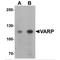 Ankyrin Repeat Domain 27 antibody, MBS150855, MyBioSource, Western Blot image 