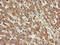 FERM, ARH/RhoGEF And Pleckstrin Domain Protein 1 antibody, CSB-PA897492LA01HU, Cusabio, Immunohistochemistry paraffin image 