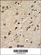 DEAD-Box Helicase 5 antibody, 62-931, ProSci, Immunohistochemistry paraffin image 