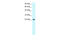 MAX Dimerization Protein 4 antibody, ARP32777_P050, Aviva Systems Biology, Western Blot image 