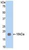 Membrane Metalloendopeptidase antibody, MBS2027798, MyBioSource, Western Blot image 