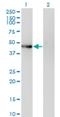 Phosphorylase Kinase Catalytic Subunit Gamma 2 antibody, H00005261-M04, Novus Biologicals, Western Blot image 