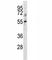 Transforming Growth Factor Beta Receptor 1 antibody, F44154-0.4ML, NSJ Bioreagents, Western Blot image 