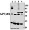 G Protein-Coupled Receptor 180 antibody, A15497-1, Boster Biological Technology, Western Blot image 