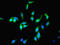 Phosphoenolpyruvate Carboxykinase 1 antibody, LS-B12266, Lifespan Biosciences, Immunofluorescence image 