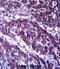 2-oxoglutarate dehydrogenase, mitochondrial antibody, abx027396, Abbexa, Immunohistochemistry paraffin image 