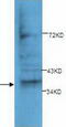 Annexin A10 antibody, TA310145, Origene, Western Blot image 