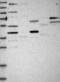 Gasdermin B antibody, NBP1-91927, Novus Biologicals, Western Blot image 