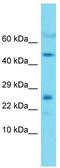 Mitochondrial Ribosomal Protein L22 antibody, TA343252, Origene, Western Blot image 