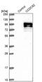Coiled-Coil Domain Containing 82 antibody, PA5-58502, Invitrogen Antibodies, Western Blot image 