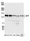 BCL2 Associated Transcription Factor 1 antibody, A300-608A, Bethyl Labs, Western Blot image 